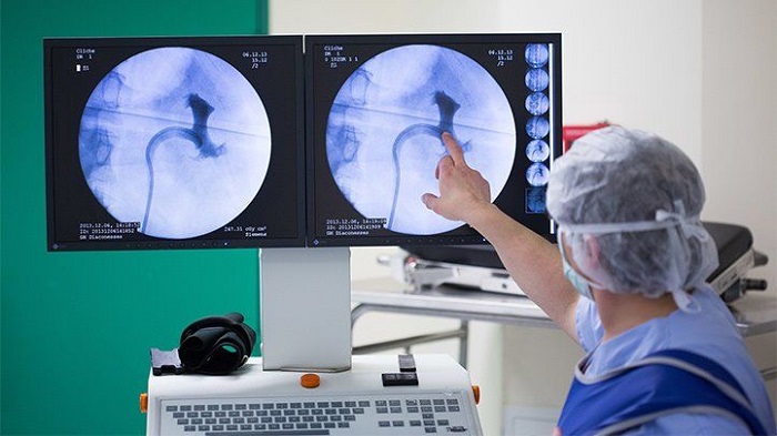 Alternate treatment options besides medications for kidney stones