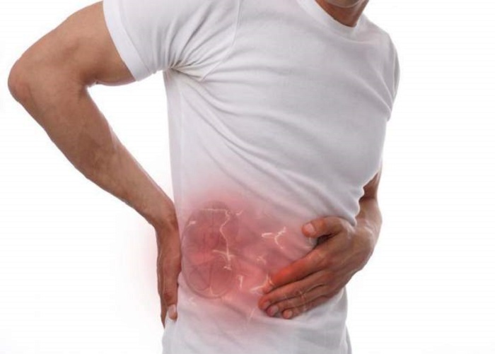 If it’s not the stone, what is hurting so badly