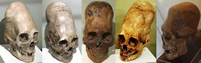 Paracas skulls are believed to belong to a species of people who weren’t human