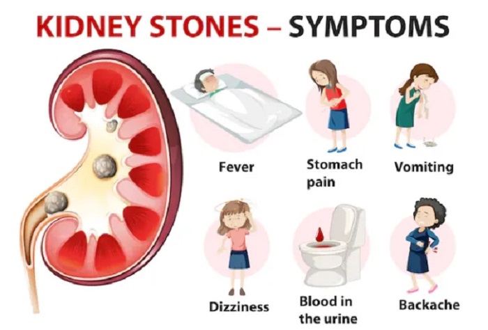 Why do kidney stones hurt so much