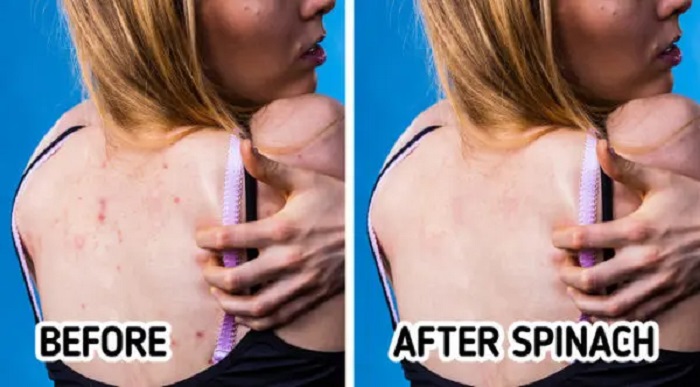 Include zinc and foods with a low GI in your diet