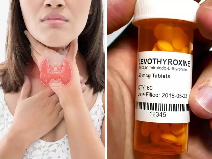 Take your prescribed thyroid medicines
