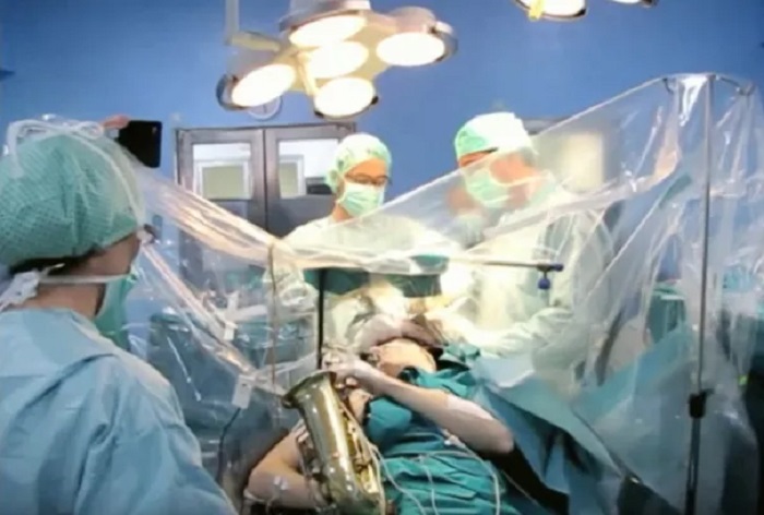 The surgery was performed by a renowned neurosurgeon specializing in complex cancers and awake surgeries The surgery was performed by a renowned neurosurgeon specializing in complex cancers and awake surgeries