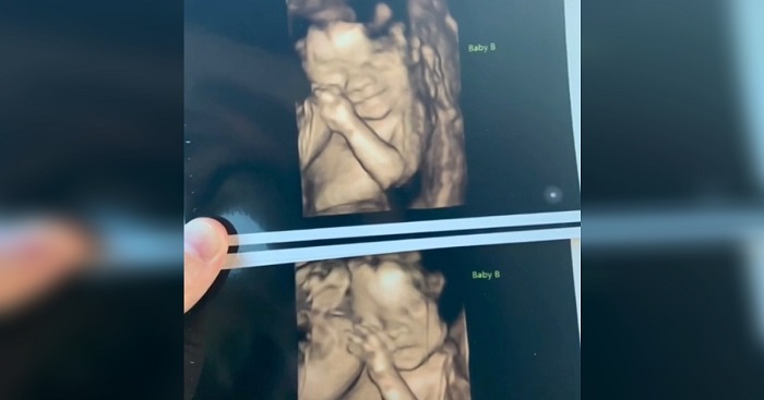 twin twins twin twins