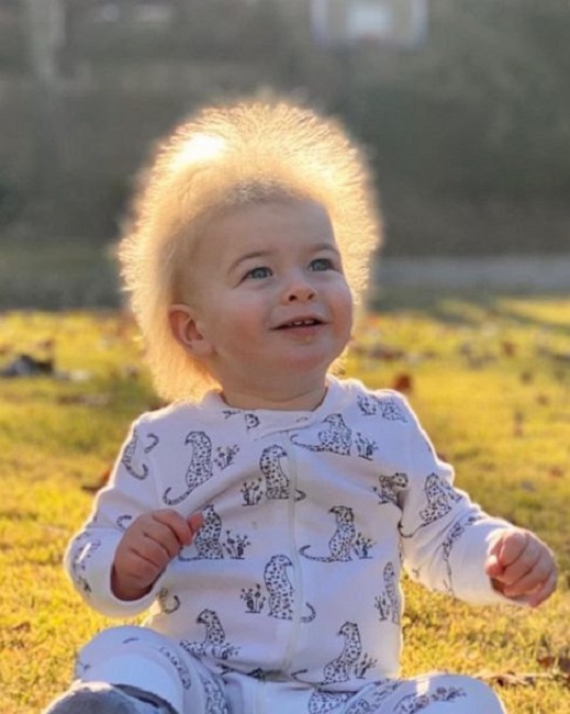 Locklin’s Instagram page @uncombable locks has gone from 3,000 to over 17,000 followers in a couple of weeks