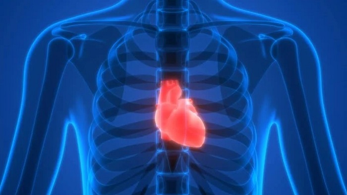 What is a heart attack