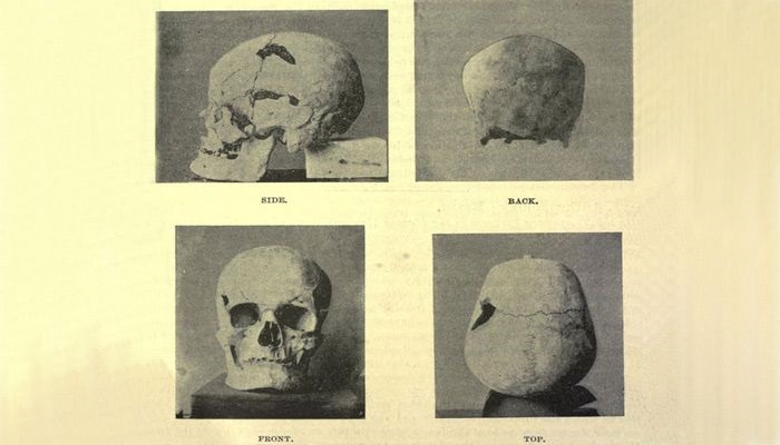 Every part of his skeleton discovered is being examined Every part of his skeleton discovered is being examined