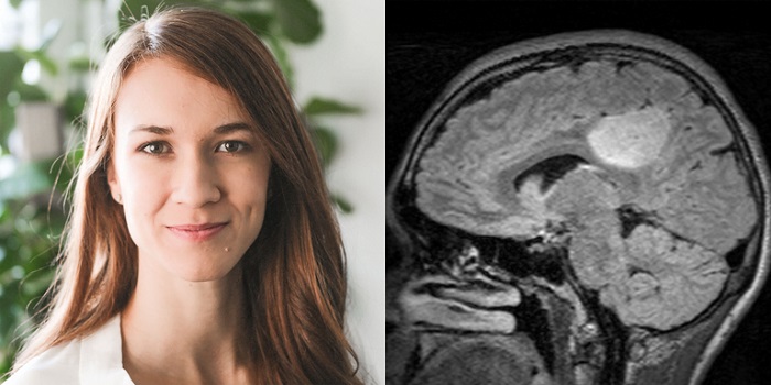 Was A.B.’s situation a similar case in which her brain tumor made her hear voices Was A.B.’s situation a similar case in which her brain tumor made her hear voices