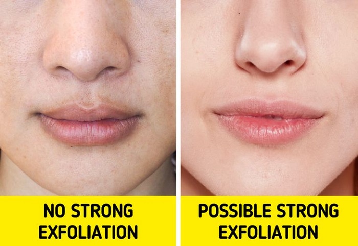 Choose an exfoliation method that suits your skin type