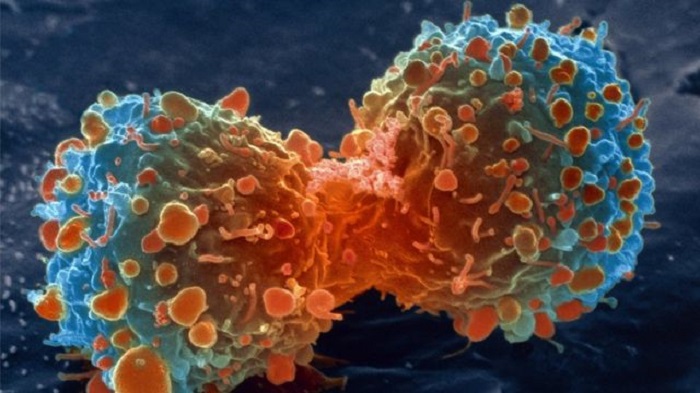 MMRd mutations make cancer cells weak to an immune response