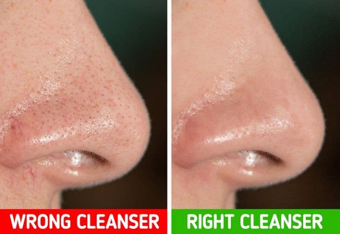 Use only those skin cleansing products that are adjusted to your skin’s natural pH