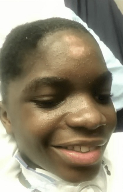 However, getting Brinson to the point where he could live on his own was difficult