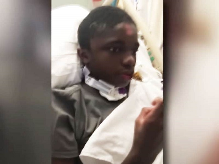 In the end, Brinson survived despite being unconscious for a few months