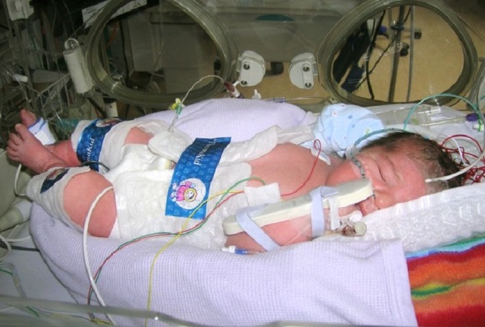 There could be some extra risks for the moms, especially if the labor is unusually challenging