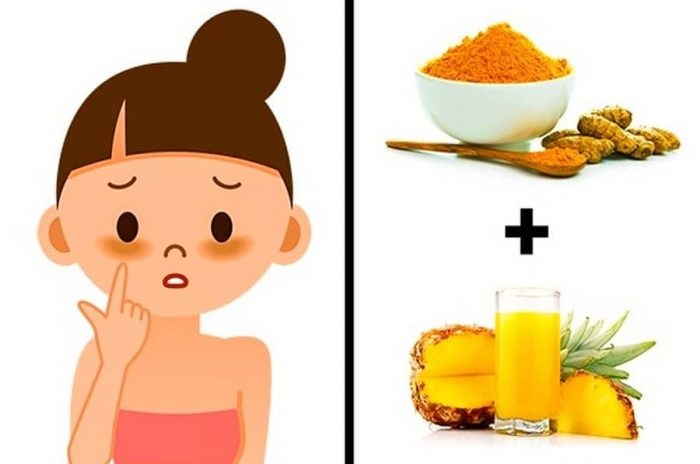 To get rid of dark circles: use pineapple juice and turmeric