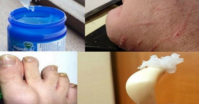 Did you know these 15 amazing uses of Vicks vaporub